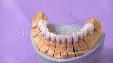 诊所牙科，安装贴面给病人在牙科诊所。 牙医<strong>美牙</strong>，微笑.. 关门